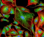 Fluorescence Microscopy: Choosing the Right lllumination System