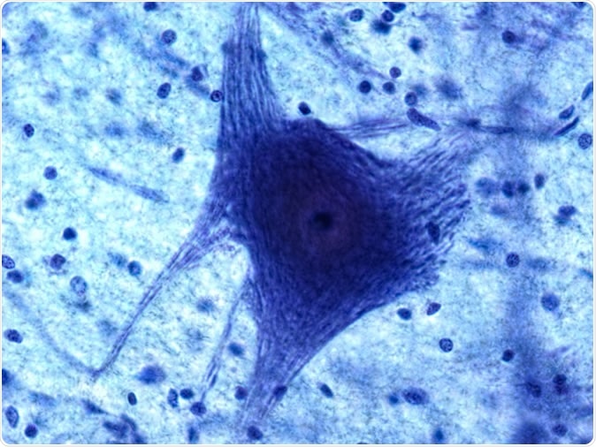 Neuron and glia at 60x. Image Credit: Christopher Meade / Shutterstock