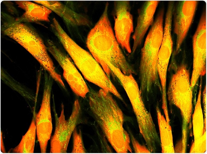 Human skin cells under confocal microscope