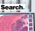 Driving Adoption of Digital Pathology with Image Search