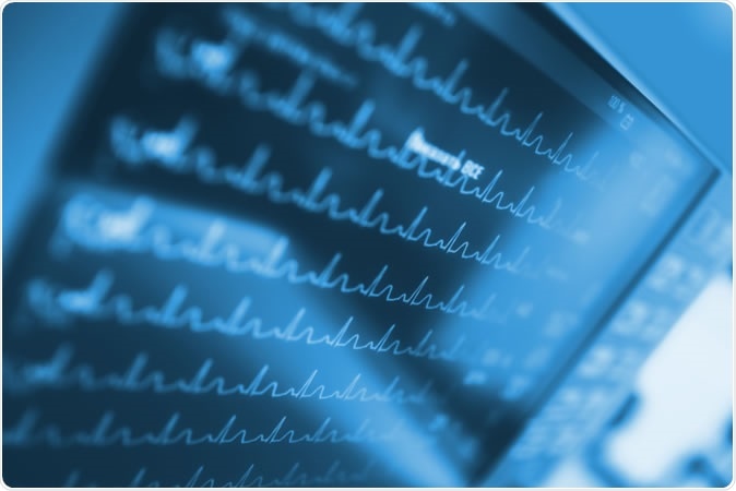 Image Credit: sfam_photo / Shutterstock