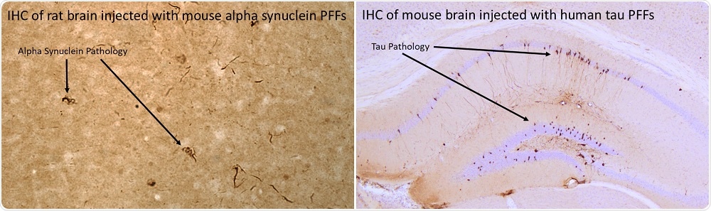 (L) Mouse alpha-synuclein PFFs induce alpha-synuclein pathology 30 days post-injection into rat brain. (R) Human P301L mutant K18 PFFs induce tau pathology nine weeks post-injection into P301L transgenic mouse brain.
