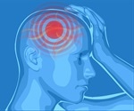 Does the Location of a Headache Matter?