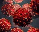 Measles warning in Western Australia