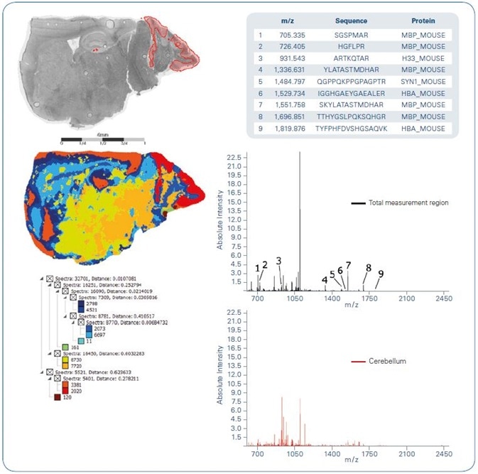 Spatial segmentation of tryptic on-tissue digest MALDI imaging data obtained from a sagittal mouse brain section. Left-hand side: Optical image overlayed with cerebellum region extracted from segmentation result (top); segmentation map (center); segmentation tree (bottom). Right-hand side: Average spectra representing total measurement region (top) and cerebellum as yielded from segmentation (bottom). Inset lists peptides that were identified by MS/MS from tissue directly.