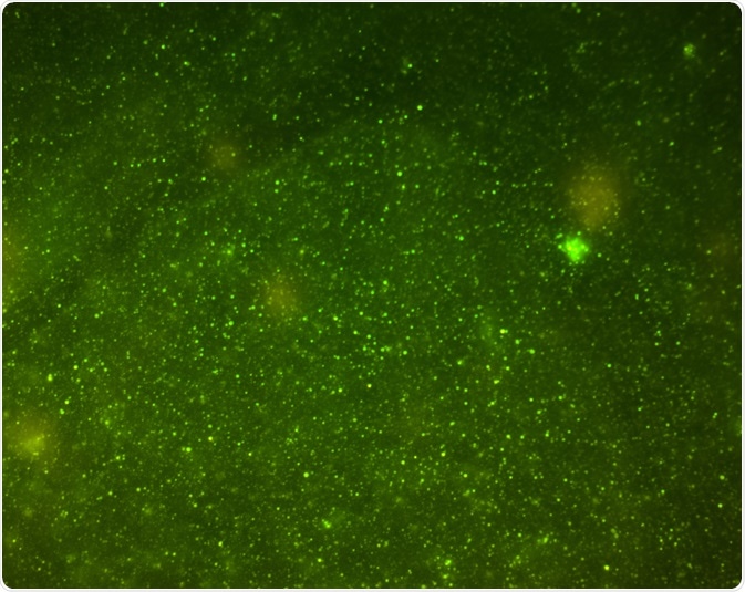 Flow cytometry uses fluorophores to detect cells for counting