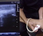 Musculoskeletal Ultrasound Uses