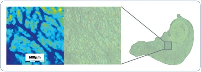 An expanded view of an ion image of m/z 644.4 from a region of human thyroid FFPE tissue to assess the MSI spatial resolution achieved using the sample analysis workflow described. Smallest structural features observed in the MSI dataset are approximately 40-50 µm, i.e. 2 pixels wide.