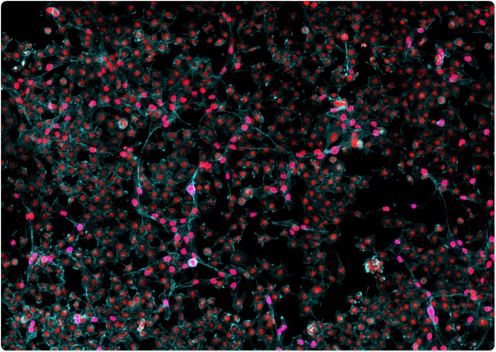 The scientists showed that the function of brain cells could be restored after the pigs had died