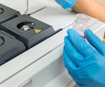 Mass Spectrometry as a Tool in Forensic Science