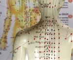 How Effective is Acupuncture?