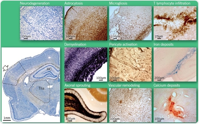 Open arrow, primary injury; HC, hippocampus; Tha, thalamus. Photomicrographs were taken from the outlined areas of the rat brain. Open arrow, primary injury; HC, hippocampus; Tha, thalamus. Photomicrographs were taken from the outlined areas of the rat brain.