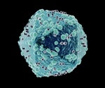 £5m for HIV/AIDS trial involving HIV patients in London, Moscow, South Africa and Australia