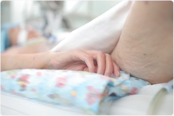 Cachexia is a condition which denotes the excessive loss of weight. It occurs because of the depletion of adipose tissue and muscle mass in people who are not trying to lose weight. Image Credit: sfam_photo / Shutterstock