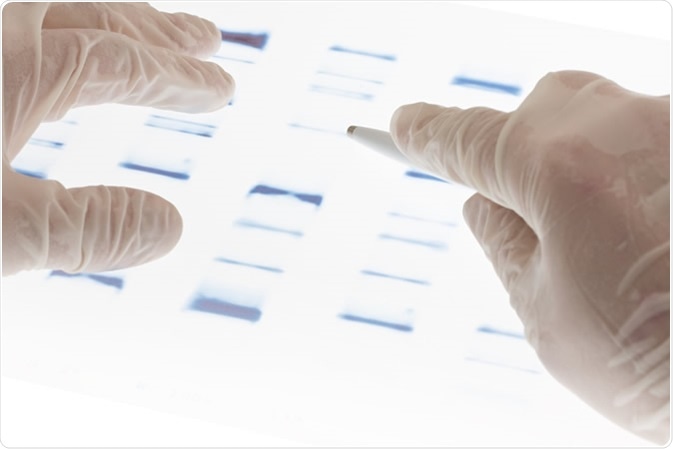Researcher examining DNA sequence transparency slide. Credit: Shawn Hempel / Shutterstock