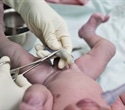 Cord blood proteins help detect early sepsis in preterm infants