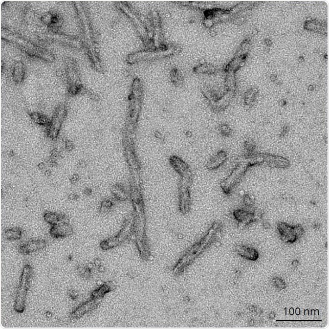 TEM of 2N4R P301S Paired Helical Filaments (SPR-463).