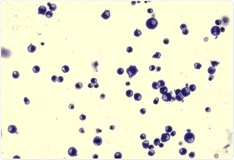 Research paves the way to improved treatment for complex blood disorders