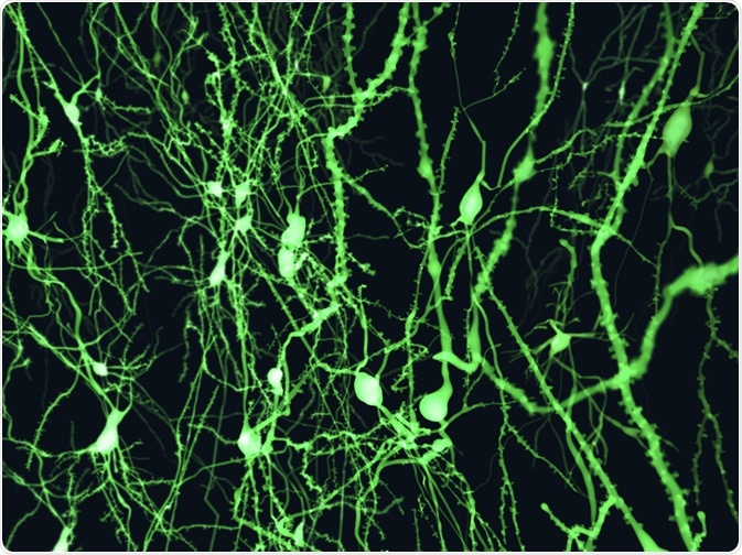 Neurons marked with fluorescence Neurons marked with fluorescence