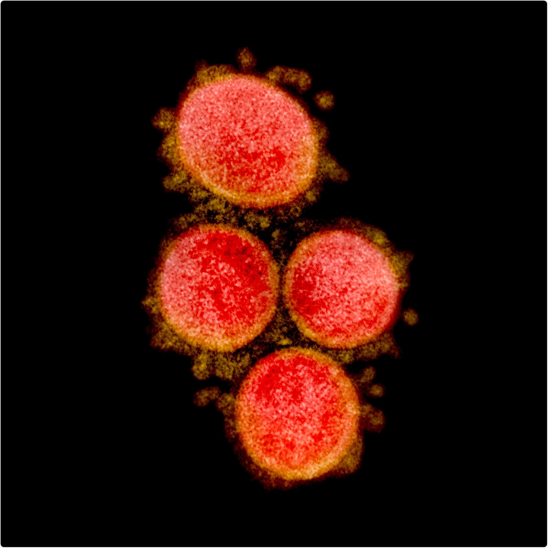Transmission electron micrograph of SARS-CoV-2 virus particles, isolated from a patient. Image captured and color-enhanced at the NIAID Integrated Research Facility (IRF) in Fort Detrick, Maryland. Credit: NIAID