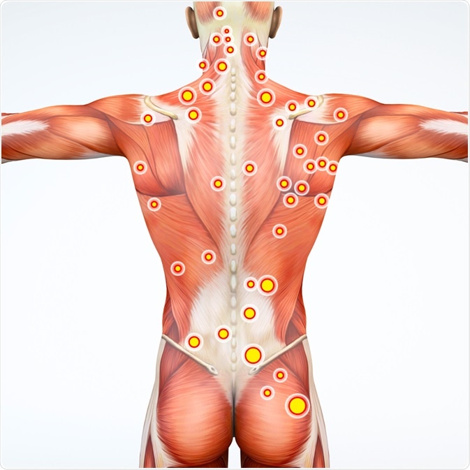 Pressure Points Pressure Points