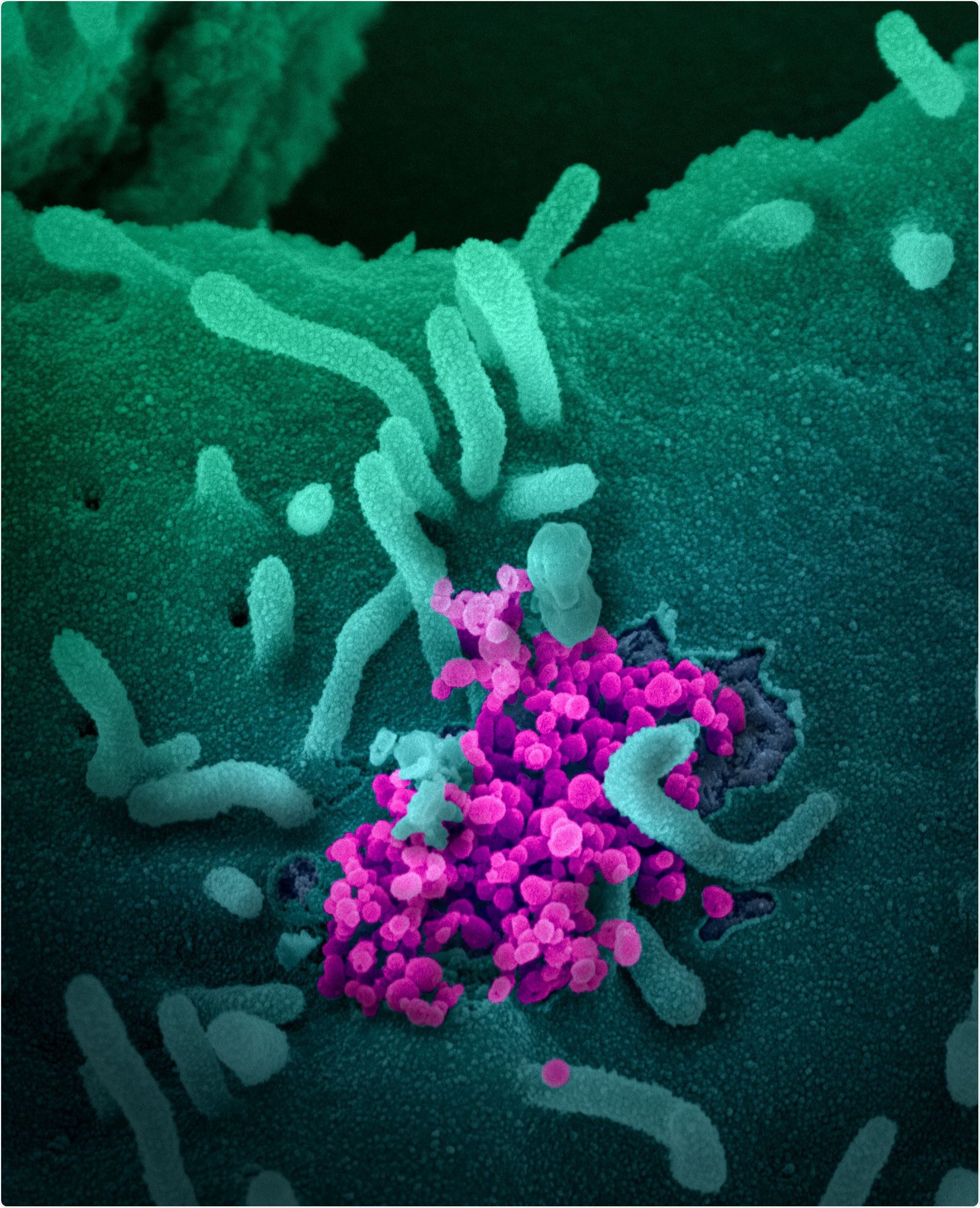 This scanning electron microscope image shows SARS-CoV-2 (round magenta objects) emerging from the surface of cells cultured in the lab. SARS-CoV-2, also known as 2019-nCoV, is the virus that causes COVID-19. The virus shown was isolated from a patient in the U.S. Image captured and colorized at NIAID