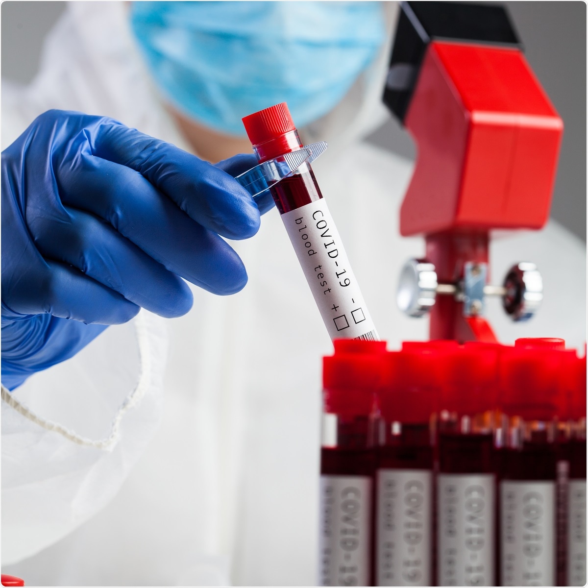 Study: Global seroprevalence of SARS-CoV-2 antibodies: a systematic review and meta-analysis. Image Credit: Cryptographer / Shutterstock