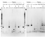 Detecting SARS-CoV-2 sequences in blood monocytes