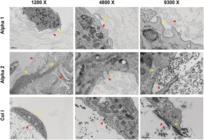 hdASC closely interact with Alpha 1 and Alpha 2 nanofibers. Transmission electron micrograph showed that hdASC (yellow arrows) are actively interacting with the SAPs nanofibers (red arrows) with cells extending processes within the hydrogel structures. At higher magnification (9300× , right panels) it was possible to identify caveolae-like structures, which were not present in control cultures of hdASC on Col I gels (bottom row).