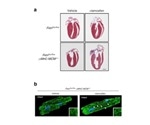 Study reveals molecular pathogenesis of muscular dystrophy-associated cardiomyopathy