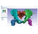 Synopsys introduces automated segmentation tool for hips and knees