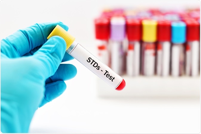 STD Test