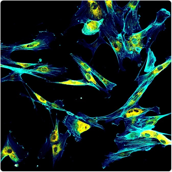 Fibroblasts Fibroblasts