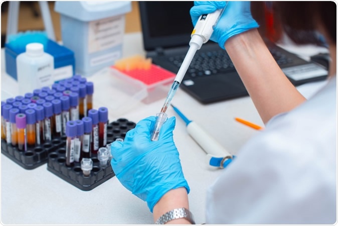 The mini-pool method allows for increasing test capacities to detect the virus with no decrease in sensitivity.  Image Credit: Salov Evgeniy / Shutterstock