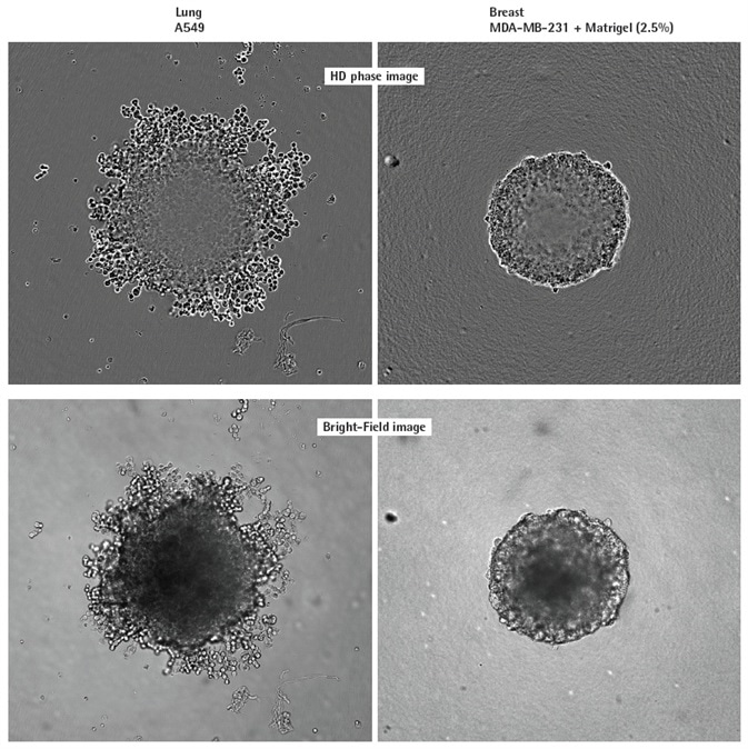 Visualizing different spheroid morphologies. High quality HD phase and corresponding BF images of spheroids formed from A549 and MDAMB-231 cells (2,500 or 5000 cells per well respectively), 72 h post seeding. Visualization of detailed phenotypic variation is observed in HD phase images. A549 cells present a loose aggregate morphology compared to the compact spheroid formed by MDA-MB-231 cells. Compaction of MDA-MB-231 aggregates into spheroids was achieved by the addition of 2.5% v/v Matrigel® post centrifugation. All images captured at 10x magnification. Visualizing different spheroid morphologies. High quality HD phase and corresponding BF images of spheroids formed from A549 and MDAMB-231 cells (2,500 or 5000 cells per well respectively), 72 h post seeding. Visualization of detailed phenotypic variation is observed in HD phase images. A549 cells present a loose aggregate morphology compared to the compact spheroid formed by MDA-MB-231 cells. Compaction of MDA-MB-231 aggregates into spheroids was achieved by the addition of 2.5% v/v Matrigel® post centrifugation. All images captured at 10x magnification.