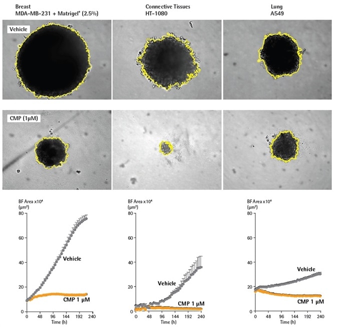 BF analysis enables accurate kinetic quantification of spheroids. The differential pharmacological effect of 1 µM CMP on growth of MDA-MB-231, HT-1080 and A549 cells in a 3D spheroid assay. Cells were grown in ULA round-bottom 96-well plates (2,500 cells per well) for 72 h and treatment with ± 1 µM CMP followed. Segmented Brightfield images compare treated vs. untreated conditions at 240 h. Time courses illustrate the specific cell type-dependent kinetic profile of spheroid growth and shrinkage. The graphs display the Largest Brightfield Object area (µm2) (y-axis) over the course of a 240 h assay (x-axis) at 6 h intervals. All images captured at 10X magnification. Each data point represents mean ±SEM, BF analysis enables accurate kinetic quantification of spheroids. The differential pharmacological effect of 1 µM CMP on growth of MDA-MB-231, HT-1080 and A549 cells in a 3D spheroid assay. Cells were grown in ULA round-bottom 96-well plates (2,500 cells per well) for 72 h and treatment with ± 1 µM CMP followed. Segmented Brightfield images compare treated vs. untreated conditions at 240 h. Time courses illustrate the specific cell type-dependent kinetic profile of spheroid growth and shrinkage. The graphs display the Largest Brightfield Object area (µm2) (y-axis) over the course of a 240 h assay (x-axis) at 6 h intervals. All images captured at 10X magnification. Each data point represents mean ±SEM,