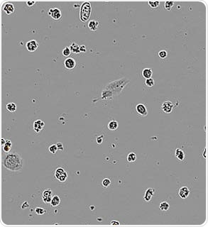 Apoptotic N2A alone.