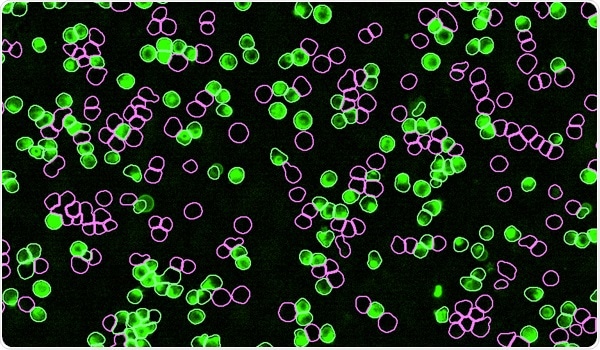 Applications IncuCyte® SX1 Live-Cell Analysis System