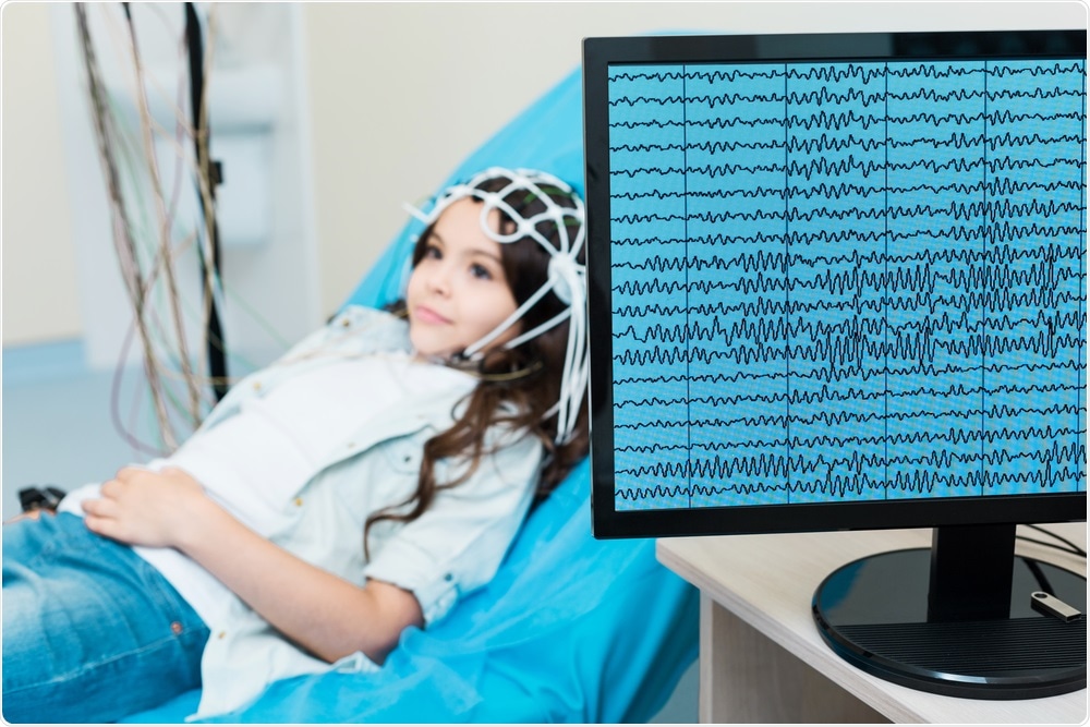 EEG Scan EEG Scan