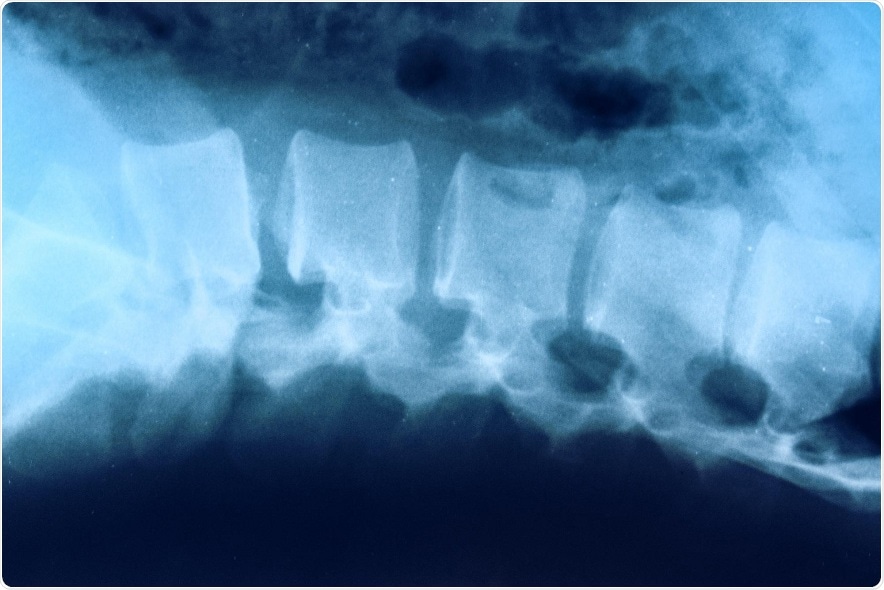 UVA scientists seek answers to questions about spinal cord injuries