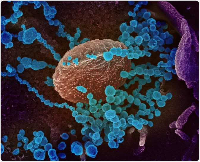 Novel Coronavirus SARS-CoV-2 This scanning electron microscope image shows SARS-CoV-2 (round blue objects) emerging from the surface of cells cultured in the lab. SARS-CoV-2, also known as 2019-nCoV, is the virus that causes COVID-19. The virus shown was isolated from a patient in the U.S. Image captured and colorized at NIAID
