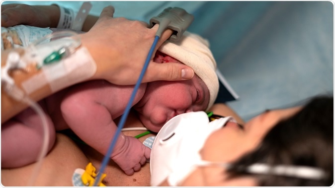 Study: SARS-CoV-2 in first trimester pregnancy - does it affect the fetus?. Image Credit: DarioSintoni / Shutterstock