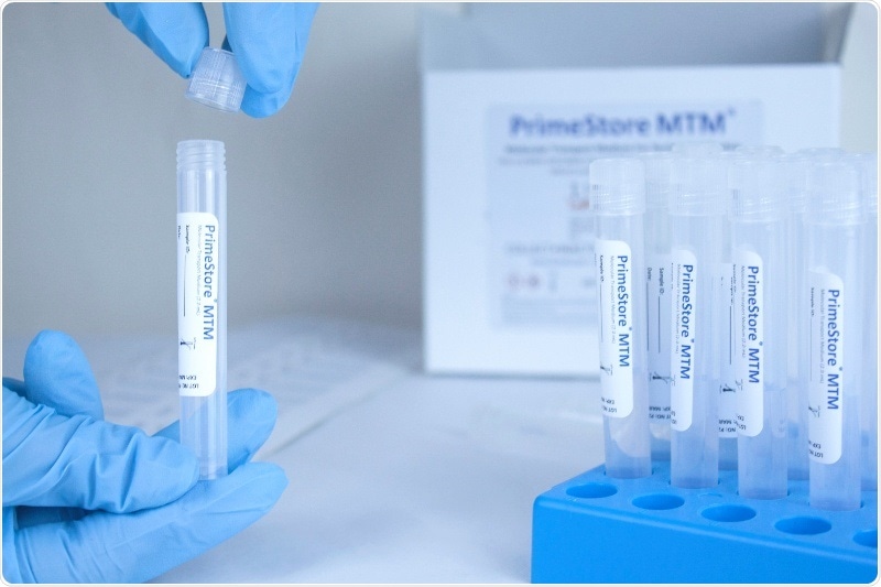 EKF secures COVID-19 novel sample collection kit manufacturing and supply contracts EKF secures COVID-19 novel sample collection kit manufacturing and supply contracts