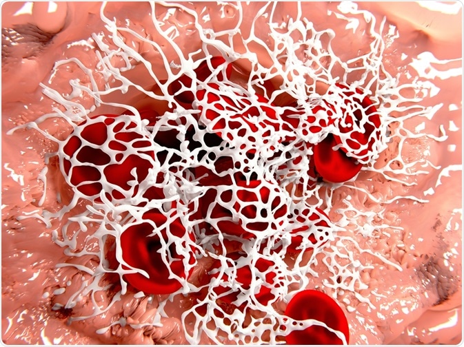 Fibrin Clot Fibrin Clot