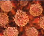 Breakthroughs in Prostate Cancer Treatments