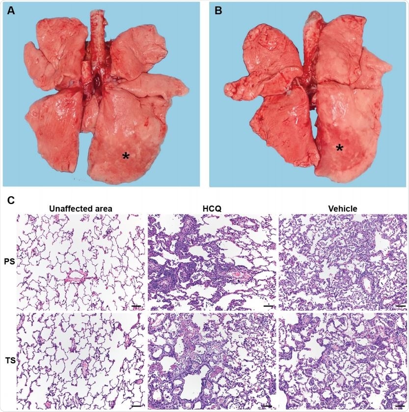 Rhesus macaque model – gross and histopathology. Macaques were infected with SARS-CoV-2 as described in the legend of Figure 2. Animals were euthanized on day 7 post368 infection for gross pathology and histopathology. (A and B) Gross pathology with consolidated lower left lung lobe and area of post-mortem-BAL in the lower right lung lobe (asterisk). (C) Hematoxylin and eosin (H&E) staining revealed multifocal, minimal to moderate, interstitial pneumonia frequently centered on terminal bronchioles. Alveolar edema and fibrin with formation of hyaline membranes was only seen in lungs with moderate changes. Multifocal perivascular infiltrates of small numbers of lymphocytes that form perivascular cuffs. The left 3panels show areas of unaffected lung tissue. Note: PS, prophylaxis; TS, treatment.