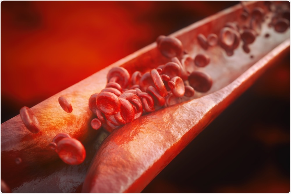 Study: Directed remodeling of the mouse gut microbiome inhibits the development of atherosclerosis. Image Credit: Crevis / Shutterstock