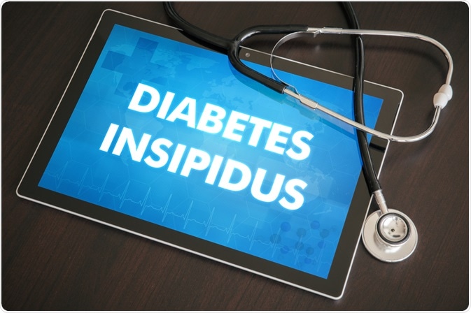 Diabetes Insipidus Diabetes Insipidus
