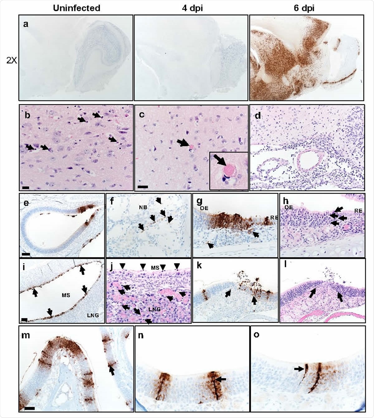 Some K18-hACE2 mice develop brain disease after SARS-CoV-2 infection