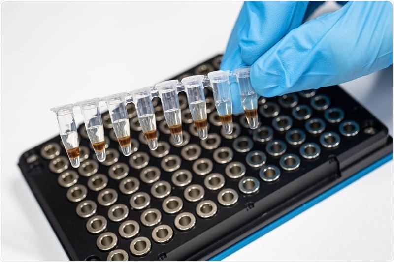 Diabetes blood markers linked to Alzheimer’s disease pathology, shows study Diabetes blood markers linked to Alzheimer’s disease pathology, shows study